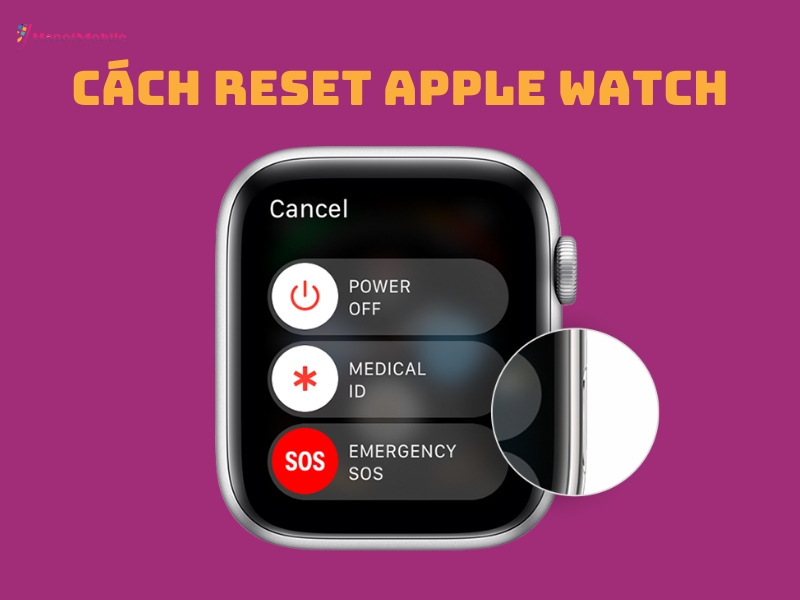 cách reset apple watch 